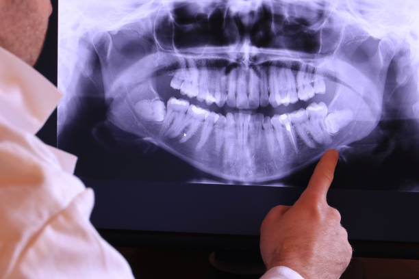 Urgent Tooth Repair in WA