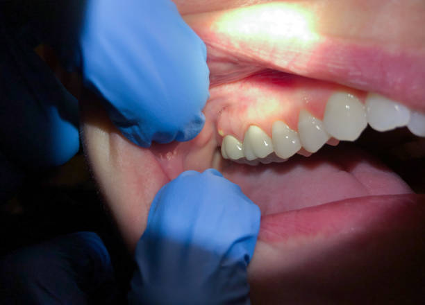 Dentist for Dental Trauma in WA