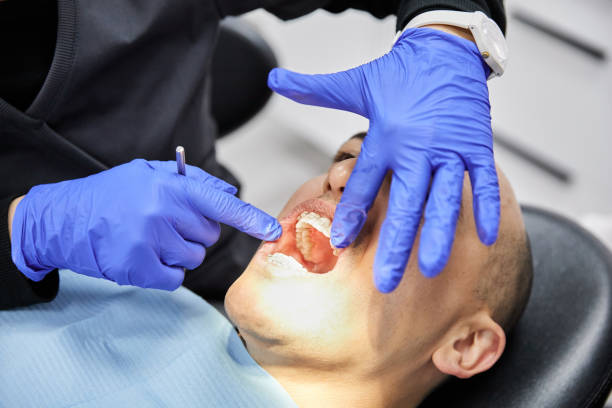 Best Cracked Tooth Emergency Dentist  in Cathcart, WA
